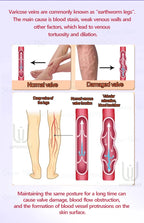 Spider leg pain relief tool