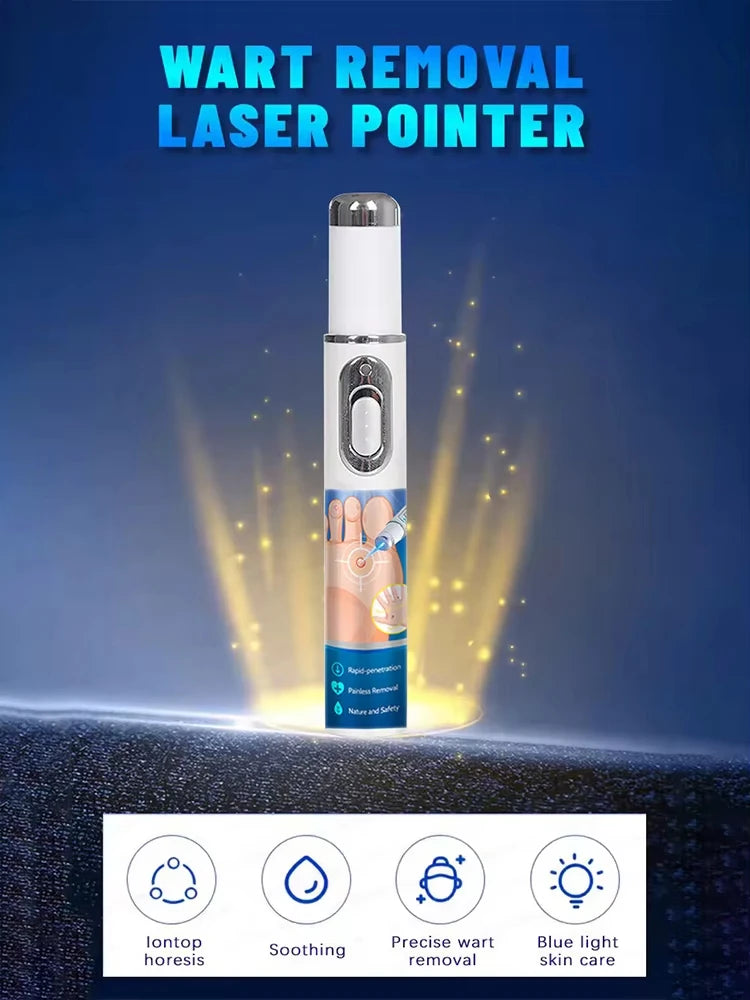 Quick and painless removal of warts, the latest generation blue light laser pen, hot-selling package