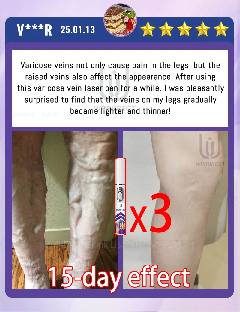 Spider leg pain relief tool