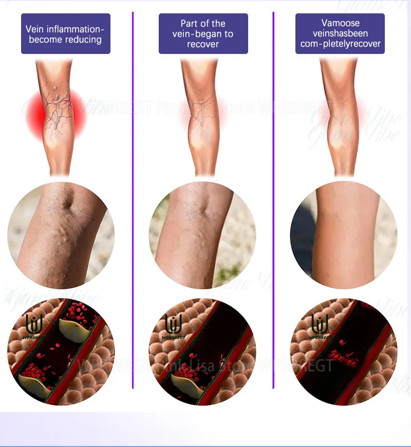 Spider leg pain relief tool