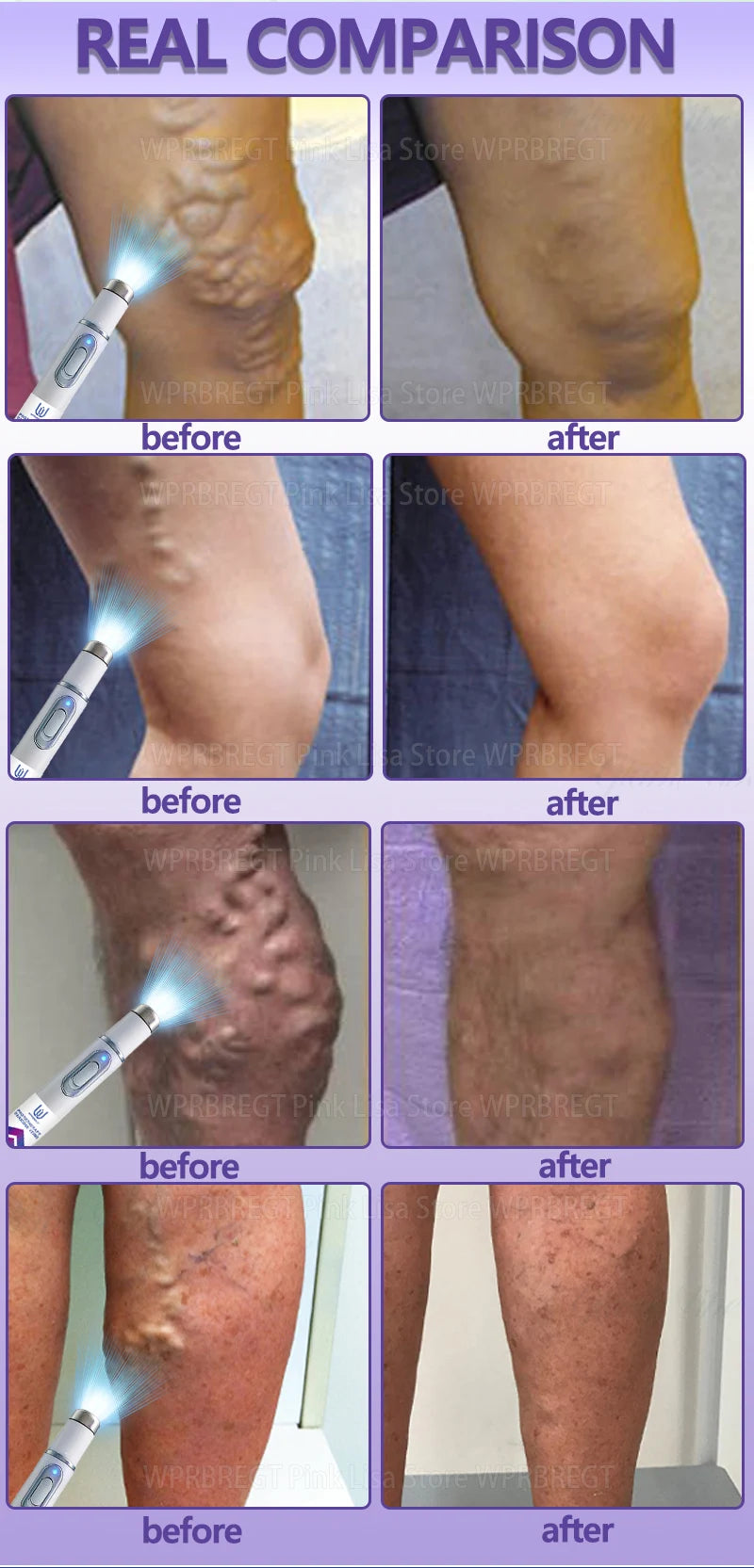 Spider leg pain relief tool