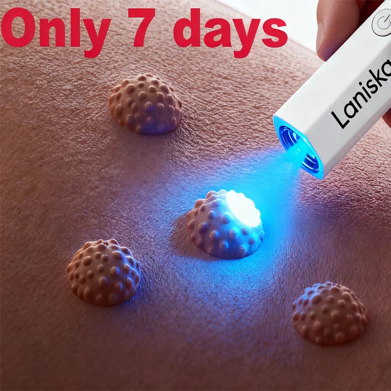 2nd ᵍᵉⁿᵉʳᵃᵗⁱᵒⁿ ᵘᵖᵍʳᵃᵈᵉᵈ wᵃʳᵗ ⸴ ᑫᵘⁱᶜᵏˡʸ， ʳᵉpᵃⁱʳ wᵃʳᵗˢ ʳᵒoᵗ