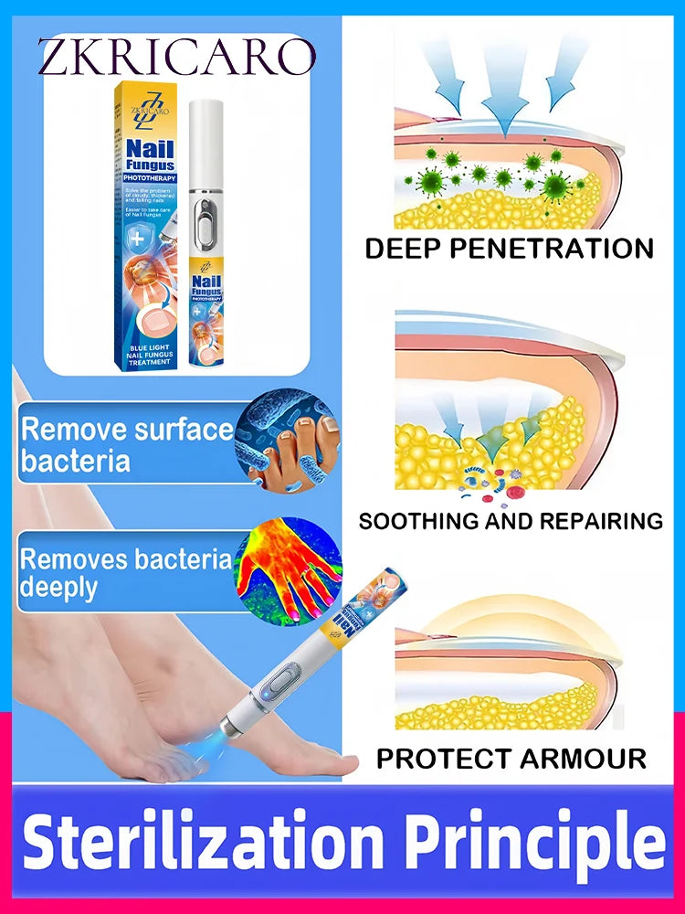 2025 Hot Sellers: Nail Cleaning Tools, Blue Light Laser Tools Root Repair Upgraded to Second Generation
