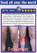 Spider leg pain relief tool